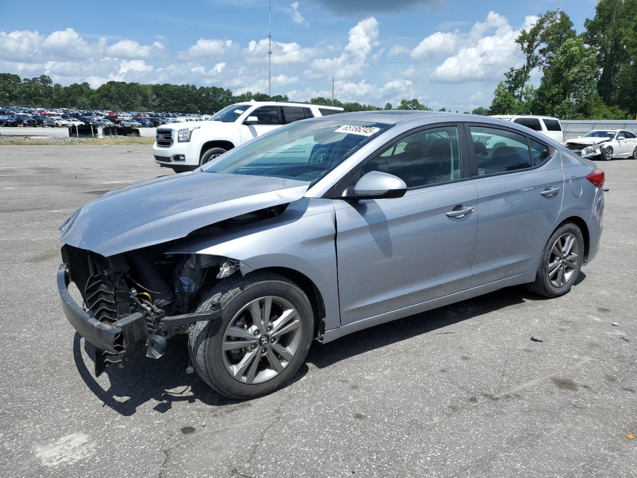 2017 Hyundai Elantra se SE