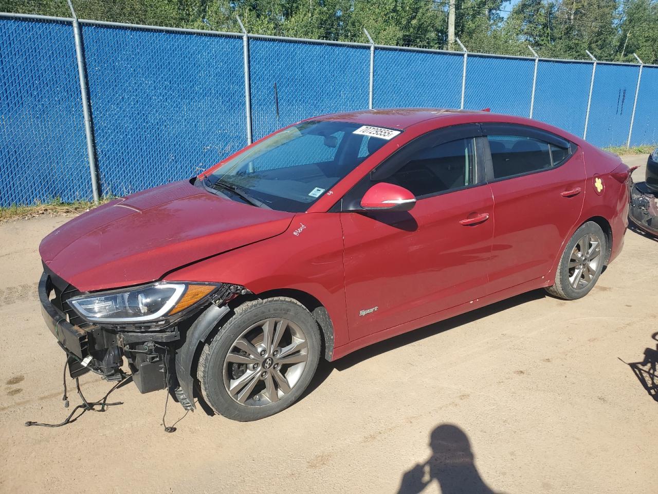 2017 Hyundai Elantra se SE