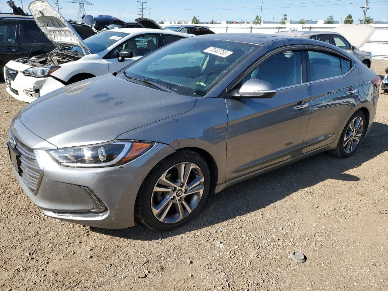 2017 Hyundai Elantra se SE