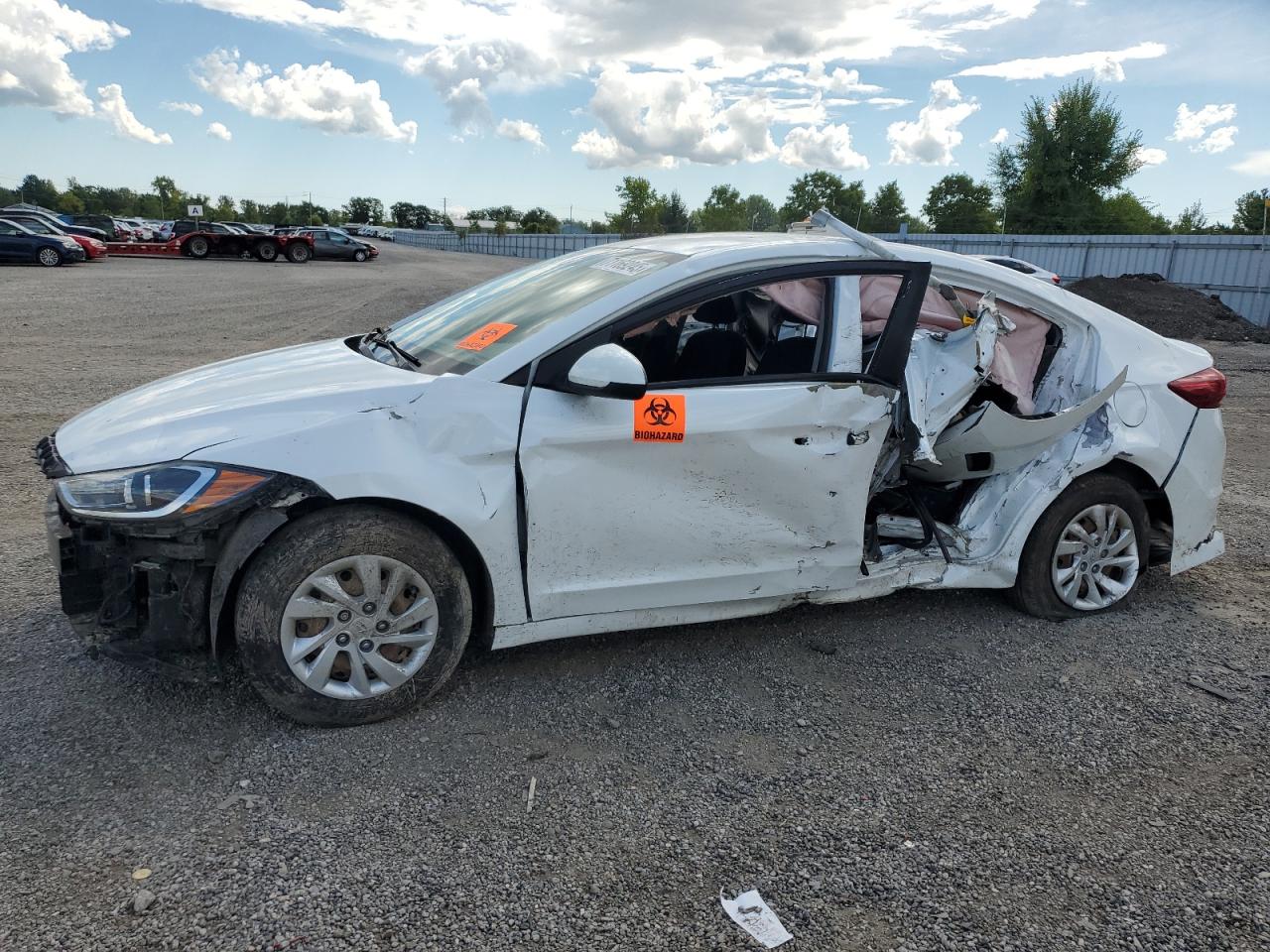 2017 Hyundai Elantra se SE