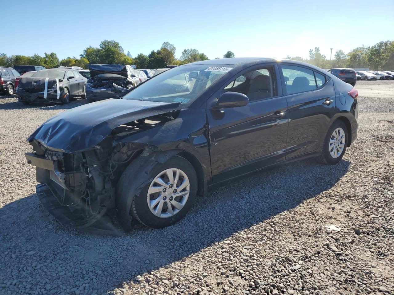 2017 Hyundai Elantra se SE