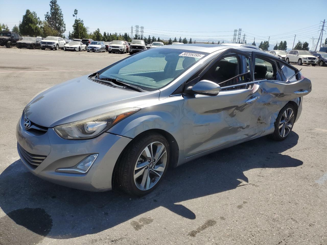 2014 Hyundai Elantra se SE