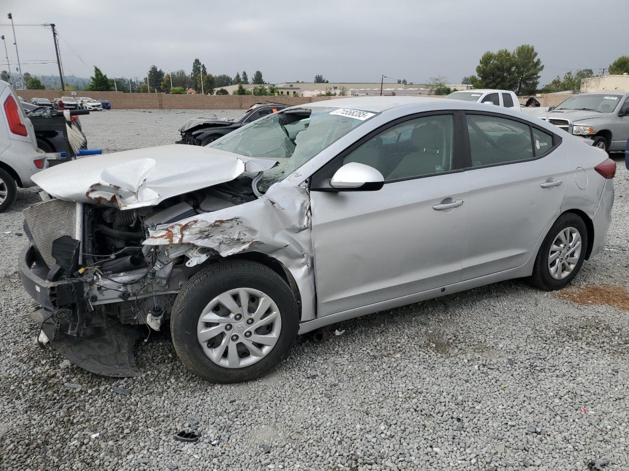 2017 Hyundai Elantra se SE