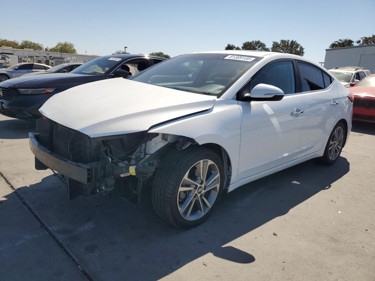 2017 Hyundai Elantra se SE