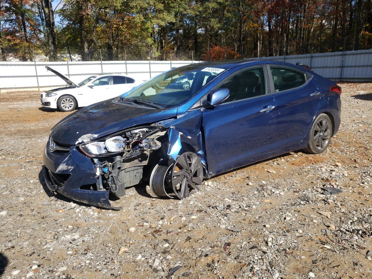 2015 Hyundai Elantra se SE